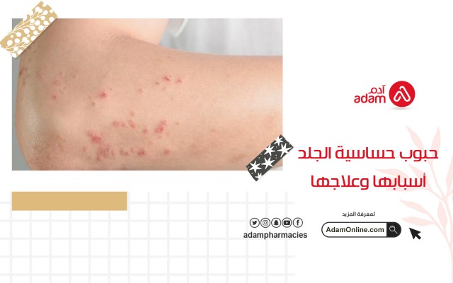 Skin allergy pills causes and treatment